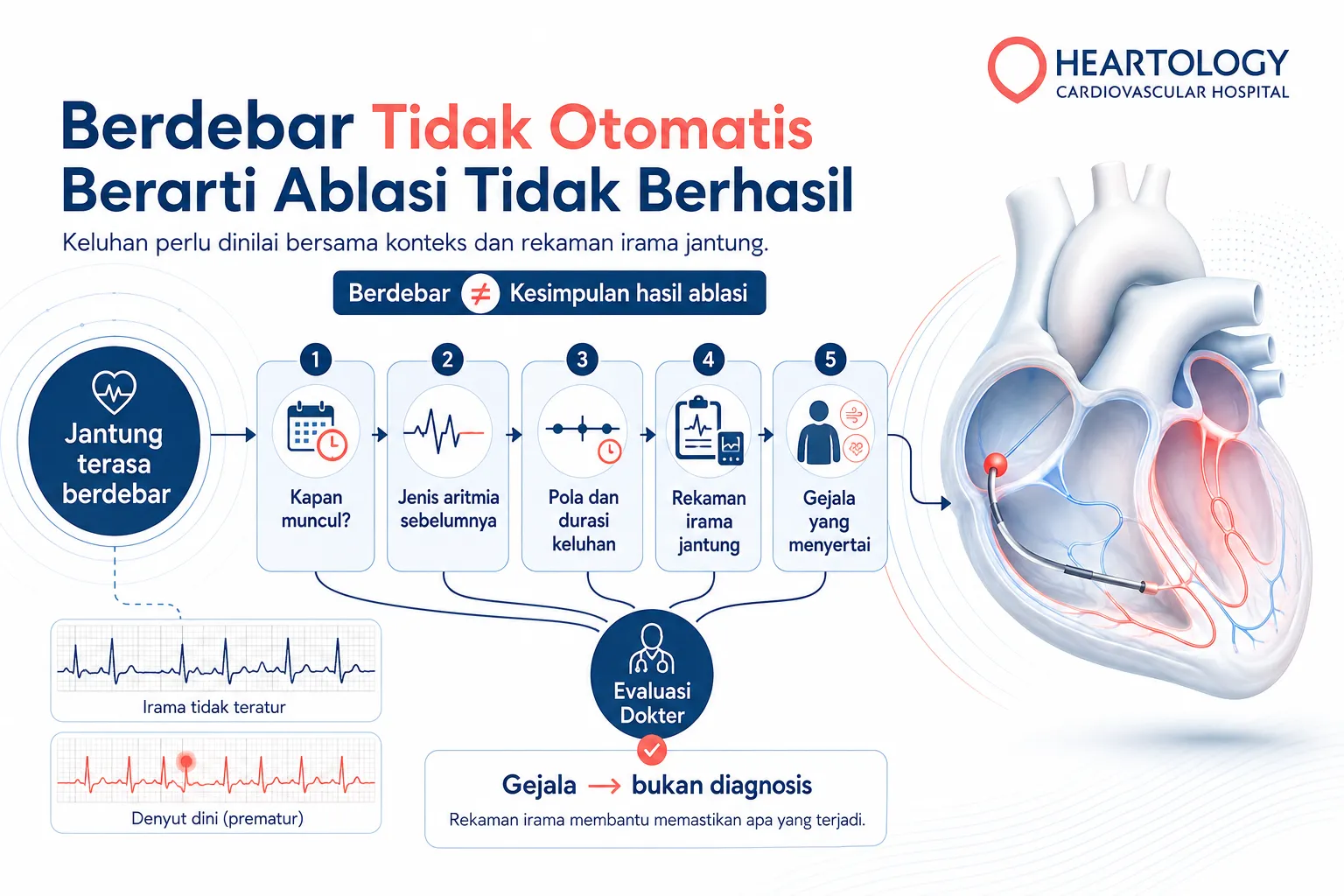Infografik Heartology berjudul “Berdebar Tidak Otomatis Berarti Ablasi Tidak Berhasil” yang menjelaskan faktor yang perlu dievaluasi saat jantung terasa berdebar setelah ablasi, termasuk waktu muncul, riwayat aritmia, pola keluhan, rekaman irama jantung, dan gejala penyerta.