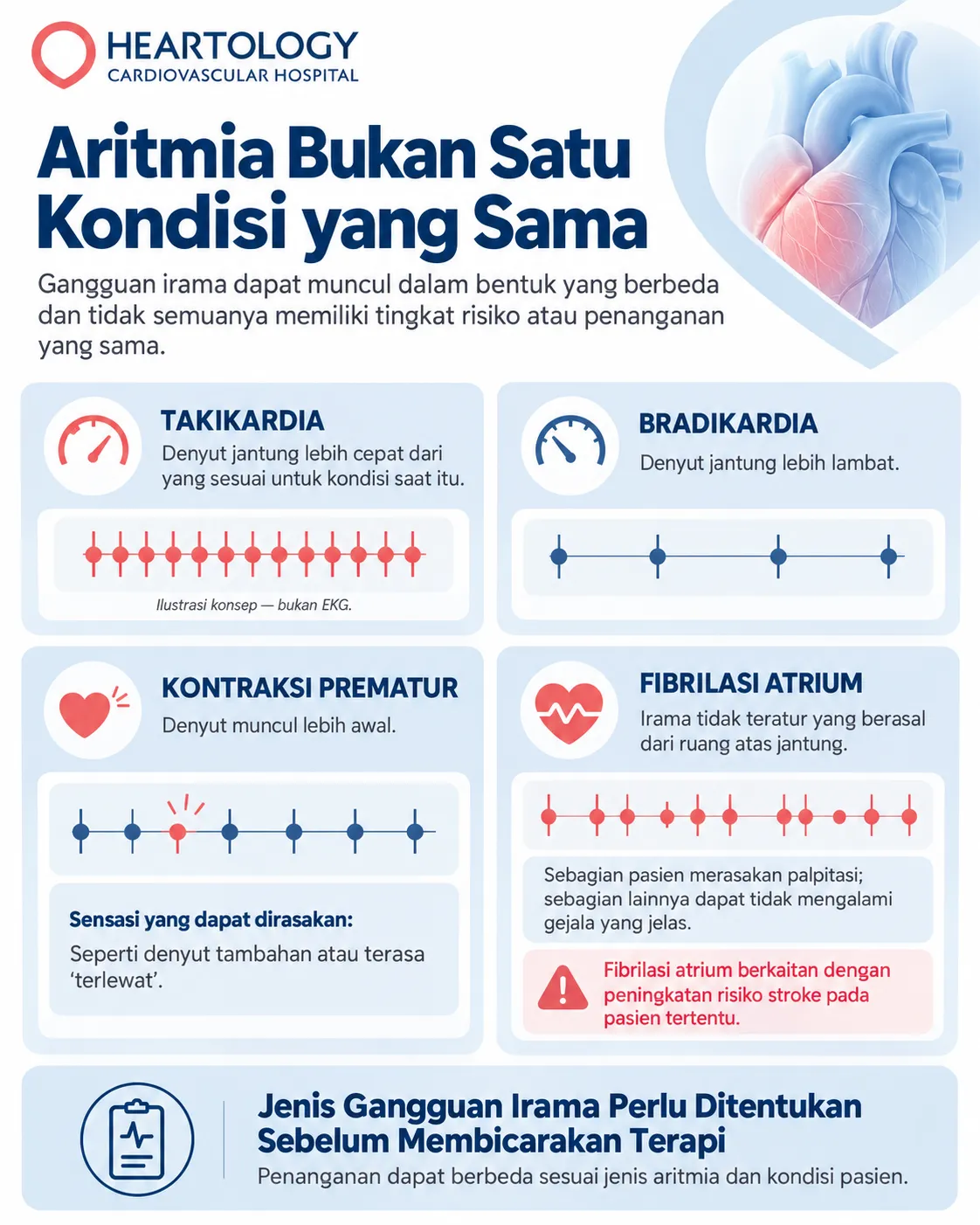 Infografik Heartology yang menjelaskan jenis aritmia seperti takikardia, bradikardia, kontraksi prematur, dan fibrilasi atrium, dengan ilustrasi pola denyut dan penjelasan bahwa penanganan dapat berbeda sesuai jenis gangguan irama dan kondisi pasien. 