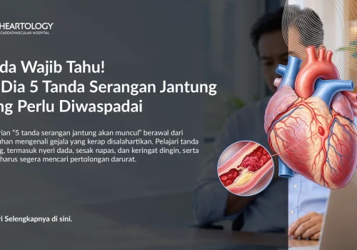 5 Tanda Serangan Jantung yang Perlu Diwaspadai