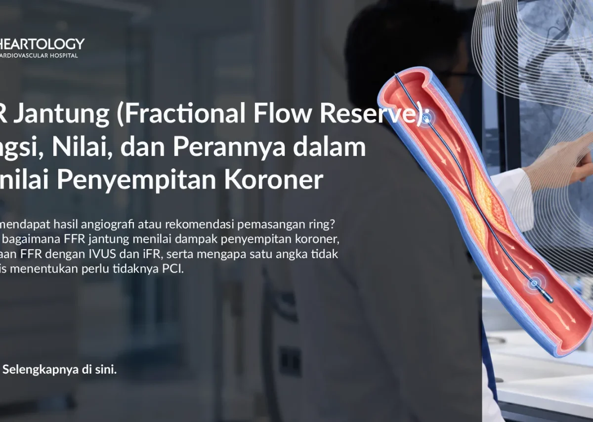 FFR Jantung (Fractional Flow Reserve): Fungsi, Nilai, dan Perannya dalam Menilai Penyempitan Koroner