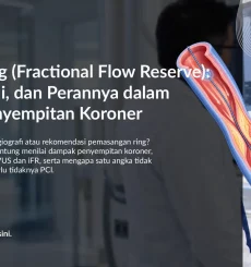FFR Jantung (Fractional Flow Reserve): Fungsi, Nilai, dan Perannya dalam Menilai Penyempitan Koroner