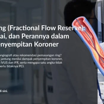 FFR Jantung (Fractional Flow Reserve): Fungsi, Nilai, dan Perannya dalam Menilai Penyempitan Koroner