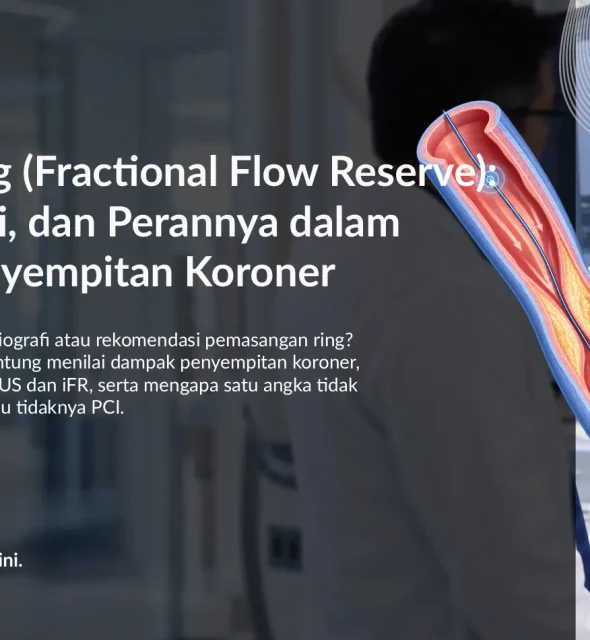 FFR Jantung (Fractional Flow Reserve): Fungsi, Nilai, dan Perannya dalam Menilai Penyempitan Koroner