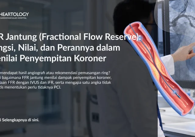 FFR Jantung (Fractional Flow Reserve): Fungsi, Nilai, dan Perannya dalam Menilai Penyempitan Koroner