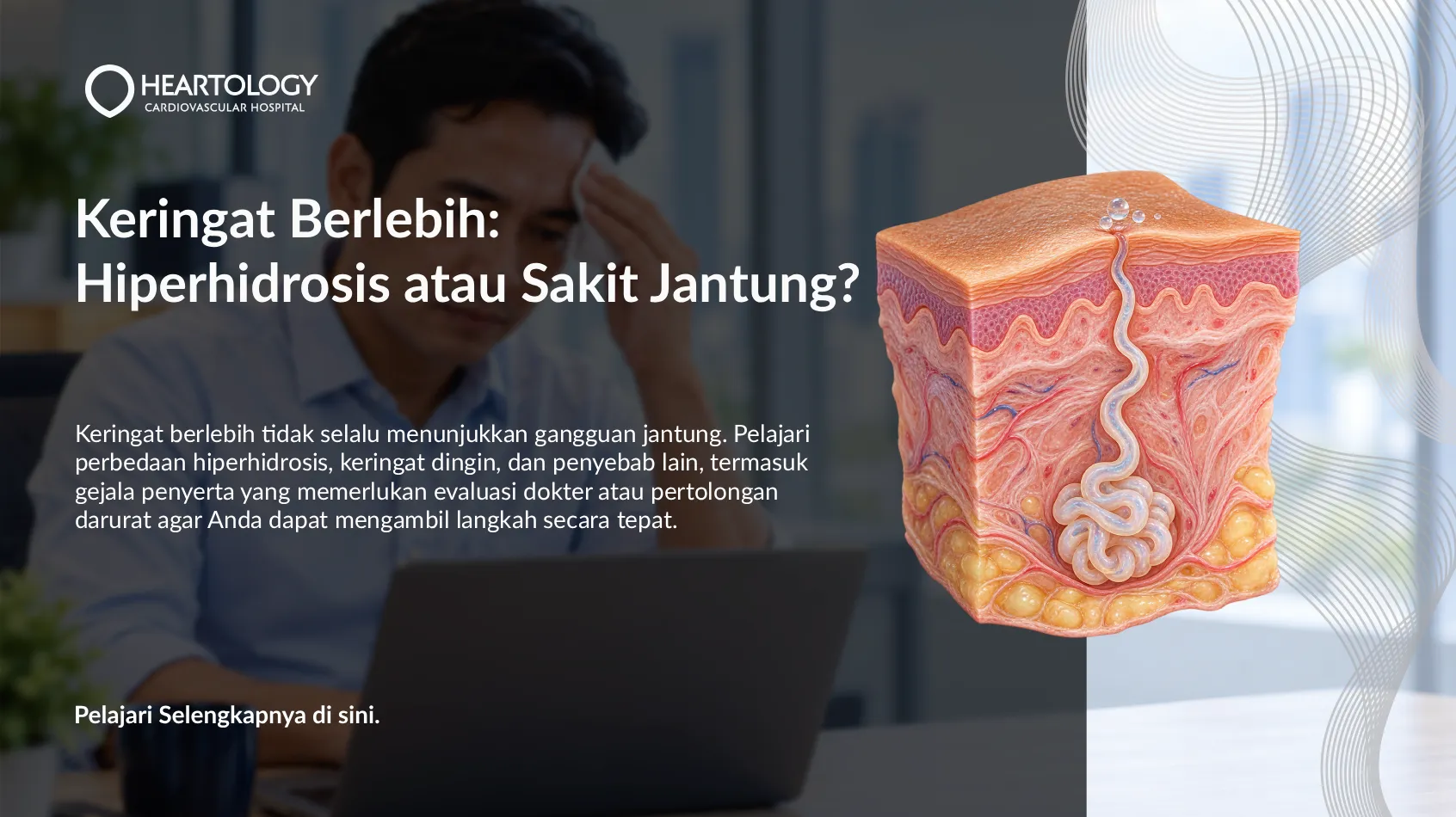 Keringat Berlebih: Hiperhidrosis atau Sakit Jantung?