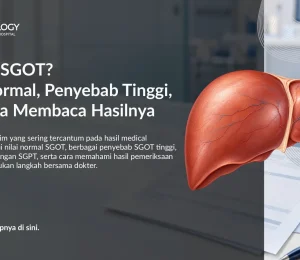SGOT: Nilai Normal, Penyebab Tinggi, dan Cara Membaca Hasilnya