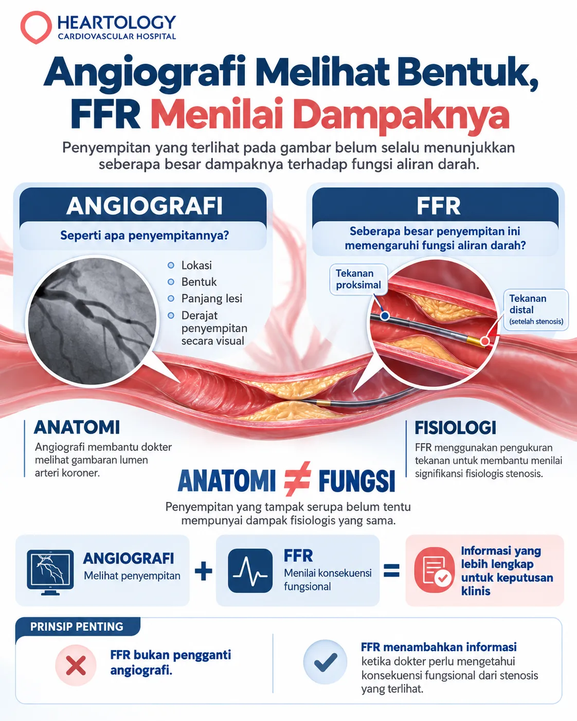 FFR jantung (Fractional Flow Reserve) dapat membantu dokter menjawab pertanyaan penting ketika ditemukan penyempitan pada pembuluh darah koroner: apakah penyempitan tersebut benar-benar menghambat aliran darah ke otot jantung secara bermakna, dan apakah informasi itu perlu memengaruhi pilihan perawatan?

Pertanyaan ini penting karena angiografi koroner dapat memperlihatkan lokasi dan gambaran penyempitan, tetapi tampilan anatomi belum selalu mencerminkan dampaknya terhadap aliran darah. Pedoman European Society of Cardiology (ESC) 2024 menegaskan bahwa tidak semua stenosis yang tampak sedang secara anatomis bersifat signifikan secara hemodinamik atau menyebabkan iskemia. [1]

Pada situasi tertentu, dokter dapat melakukan FFR saat kateterisasi atau angiografi koroner untuk memperoleh informasi fisiologis tambahan. Pemeriksaan ini menggunakan pengukuran tekanan di arteri koroner untuk memperkirakan seberapa besar suatu penyempitan membatasi kemampuan pembuluh mengalirkan darah ketika kebutuhan jantung meningkat. Pedoman nasional Kementerian Kesehatan RI juga memasukkan FFR dalam penilaian fungsional stenosis pada penyakit jantung koroner stabil. [2]

Dengan demikian, FFR bukan sekadar "angka tambahan" setelah angiografi. Nilainya membantu dokter dan pasien memahami apakah suatu lesi bermakna secara fisiologis dan bagaimana temuan tersebut perlu ditempatkan bersama gejala, anatomi koroner, serta kondisi klinis secara keseluruhan.

Baca juga: Penyakit Jantung Koroner: Gejala, Pencegahan, dan Penanganannya
Apa Itu FFR Jantung?

Fractional Flow Reserve atau FFR adalah pemeriksaan fisiologi koroner berbasis tekanan yang membantu dokter menilai apakah suatu penyempitan arteri koroner mempunyai dampak bermakna terhadap kemampuan pembuluh memasok darah ke otot jantung.

Arteri koroner membawa darah kaya oksigen ke otot jantung. Ketika plak aterosklerosis mempersempit pembuluh tersebut, dokter tidak hanya perlu melihat seberapa sempit lumen pada gambar. Dalam kondisi tertentu, penting juga untuk mengetahui apakah stenosis itu benar-benar mengurangi kapasitas aliran darah saat jantung membutuhkannya.

Secara teknis, FFR dihitung dari perbandingan tekanan koroner setelah atau distal dari lesi dengan tekanan aorta saat terjadi hiperemia maksimal, yaitu kondisi ketika resistensi pembuluh darah kecil di jantung dibuat serendah mungkin. Dengan kondisi ini, efek penyempitan terhadap sirkulasi koroner dapat dinilai lebih jelas. Scientific statement AHA mengenai fisiologi koroner invasif menempatkan FFR sebagai salah satu metode utama penilaian fisiologi koroner invasif. [3]
Apa yang Sebenarnya Diukur FFR?

FFR sering disalahpahami sebagai pemeriksaan untuk menghitung "berapa persen pembuluh tersumbat". Padahal, itu bukan fungsi utamanya.

Persentase penyempitan yang terlihat melalui angiografi merupakan informasi anatomis. Sebaliknya, FFR memberikan informasi fisiologis mengenai akibat penyempitan tersebut.

Angiografi melihat bentuk penyempitan. FFR membantu menilai dampaknya.

FFR juga bukan pengukuran langsung volume aliran darah dalam satuan tertentu. FFR adalah indeks berbasis tekanan yang digunakan untuk memperkirakan pengaruh stenosis terhadap aliran darah maksimum yang dapat dicapai.

Perbedaan tersebut penting. ESC mencatat bahwa derajat stenosis secara visual dapat tidak sejalan dengan signifikansi fisiologisnya. Artinya, lesi yang terlihat cukup sempit belum tentu mempunyai dampak fisiologis yang sama besarnya, dan sebaliknya. [1]
Mengapa Angiografi Belum Cukup?

Angiografi koroner memberikan informasi anatomi yang sangat penting, tetapi pada stenosis tertentu dokter memerlukan data fisiologis untuk mengetahui apakah penyempitan benar-benar menghambat aliran darah secara bermakna.

Angiografi memungkinkan dokter menilai lokasi, bentuk, panjang, dan derajat visual suatu penyempitan. Namun, anatomi dan fisiologi menjawab dua pertanyaan yang berbeda:

    Angiografi: "Seperti apa penyempitannya?"
    FFR: "Seberapa besar penyempitan ini memengaruhi fungsi aliran darah?"

Karena itu, penggunaan FFR bukan berarti hasil angiografi "kurang akurat". Kedua pemeriksaan justru dapat saling melengkapi.

Perbedaan ini paling relevan pada stenosis derajat menengah (intermediate), serta pada kasus dengan beberapa penyempitan yang membuat dokter perlu menentukan lesi mana yang paling mungkin berkaitan dengan iskemia. ESC merekomendasikan penilaian fisiologi invasif seperti FFR atau iFR sebelum revaskularisasi ketika signifikansi fungsional stenosis derajat menengah perlu dipastikan. [1]
Anatomi dan Fungsi Berbeda

Bayangkan dua ruas jalan yang sama-sama tampak menyempit. Pada ruas pertama, kendaraan masih dapat lewat tanpa gangguan berarti. Pada ruas lain, bentuk, panjang, dan posisi penyempitan menimbulkan kemacetan jauh lebih besar.

Foto jalan memberi informasi mengenai bentuk penyempitan. Namun, untuk memahami dampaknya, kita juga perlu mengetahui bagaimana lalu lintas bergerak melewatinya.

Pembuluh koroner tentu jauh lebih kompleks daripada jalan raya. Meskipun begitu, analogi tersebut menggambarkan mengapa anatomi saja tidak selalu dapat memprediksi konsekuensi fisiologis secara sempurna.

Baca juga: Angiografi Koroner: Kapan Dilakukan dan Bagaimana Prosedurnya?
Kapan FFR Diperlukan?

FFR tidak diperlukan pada setiap penyempitan koroner. Pemeriksaan ini digunakan ketika informasi fisiologis tambahan dapat membantu menentukan apakah suatu lesi perlu menjadi target revaskularisasi.

Pedoman ACC/AHA/SCAI merekomendasikan FFR atau iFR untuk membantu mengambil keputusan PCI pada pasien dengan angina atau gejala ekuivalen, bukti iskemia yang belum terdokumentasi, dan stenosis angiografik derajat menengah. [4]

Dalam praktik, FFR dapat dipertimbangkan ketika:

    angiografi menunjukkan stenosis yang signifikansinya belum jelas;
    terdapat beberapa lesi dan dokter perlu menentukan lesi yang paling bermakna;
    gejala dan gambaran anatomi belum memberikan penjelasan yang konsisten;
    sedang dipertimbangkan apakah suatu lesi perlu menjadi target PCI;
    hasil fisiologi berpotensi mengubah strategi revaskularisasi.

PNPK Angina Pektoris Stabil dari Kementerian Kesehatan RI juga menyebut pengukuran FFR dengan hiperemia sebagai cara membantu mengidentifikasi stenosis yang bermakna secara fungsional atau hemodinamik. [2]
Apakah Semua Penyempitan Perlu FFR?

Tidak. Jika informasi klinis dan anatomi sudah cukup untuk menentukan langkah penanganan, dokter mungkin tidak memerlukan FFR. Sebaliknya, pada kasus tertentu pemeriksaan ini berguna untuk mengurangi ketidakpastian.

Karena itu, aturan seperti "Sumbatan sekian persen pasti harus diperiksa dengan FFR" terlalu sederhana untuk diterapkan pada semua pasien.

Selain itu, penggunaan dan interpretasi FFR pada sindrom koroner akut mempunyai pertimbangan yang berbeda dibandingkan penyakit koroner stabil. Scientific statement AHA mengenai fisiologi koroner invasif menempatkan sindrom koroner akut sebagai salah satu kelompok yang memerlukan interpretasi fisiologi secara lebih kontekstual. [3]
Bagaimana Cara Kerja FFR?

FFR menilai pengaruh stenosis dengan membandingkan tekanan koroner distal dengan tekanan aorta ketika aliran koroner berada pada kondisi hiperemia maksimal.

Dokter menggunakan pressure wire, yaitu kawat tipis khusus dengan sensor tekanan. Kawat tersebut diarahkan melewati stenosis yang ingin dinilai.

Selanjutnya, dokter mengukur tekanan di bagian arteri setelah lesi dan membandingkannya dengan tekanan aorta. Pada FFR konvensional, vasodilator seperti adenosin dapat digunakan untuk menghasilkan hiperemia maksimal sehingga efek stenosis terhadap sirkulasi koroner terlihat lebih jelas. Scientific statement AHA mengenai fisiologi koroner invasif juga membahas penggunaan adenosin sebagai bagian penting dalam standardisasi pengukuran FFR. [3]

Secara sederhana, prosesnya adalah:

    angiografi menemukan lesi yang perlu dievaluasi;
    pressure wire melewati stenosis;
    tekanan koroner diukur saat hiperemia;
    sistem menghitung nilai FFR;
    dokter menginterpretasikan hasil bersama informasi klinis lainnya.

Apa Peran Pressure Wire?

Pressure wire berbeda dari guidewire biasa karena dilengkapi sensor tekanan. Saat pengukuran, sensor pressure wire ditempatkan di sisi distal lesi sehingga dokter dapat membandingkan tekanan tersebut dengan tekanan aorta.

Karena itu, posisi sensor dan kualitas sinyal penting untuk menghasilkan pengukuran yang dapat dipercaya. Scientific statement AHA mengenai fisiologi koroner invasif menekankan berbagai aspek teknis seperti posisi sensor, kemungkinan pergeseran pembacaan tekanan (pressure drift), dan teknik hiperemia karena kualitas pengukuran dapat memengaruhi interpretasi. [3]
Bagaimana Prosedur FFR Dilakukan?

Pemeriksaan FFR biasanya dilakukan sebagai bagian dari angiografi atau kateterisasi koroner di cath lab, bukan sebagai tes terpisah seperti EKG atau pemeriksaan darah.
Sebelum Pemeriksaan

Sebelum prosedur, tim medis akan meninjau kondisi kesehatan dan pemeriksaan sebelumnya. Informasi yang perlu disampaikan antara lain:

    obat yang sedang digunakan;
    alergi obat atau media kontras;
    penyakit penyerta;
    riwayat tindakan jantung;
    hasil laboratorium dan pencitraan sebelumnya.

Instruksi puasa atau penyesuaian obat dapat berbeda untuk setiap pasien. Karena itu, jangan menghentikan pengencer darah, obat jantung, obat diabetes, atau obat lain atas keputusan sendiri. Ikuti arahan dokter atau tim cath lab.
Saat Pemeriksaan

Kateter dimasukkan melalui pembuluh darah dan diarahkan menuju arteri koroner dengan panduan pencitraan. Akses sering dilakukan melalui pergelangan tangan atau lipat paha, sesuai kebutuhan klinis.

Jika suatu stenosis perlu dievaluasi dengan FFR:

    pressure wire diarahkan melewati lesi;
    tekanan diukur;
    obat vasodilator dapat diberikan untuk menghasilkan hiperemia;
    nilai FFR dihitung;
    dokter menilai hasil tersebut bersama angiografi.

Pasien tetap dipantau selama prosedur. [5]
Setelah Pemeriksaan

Sesudah kateter dan pressure wire dilepas, proses pemulihan mengikuti prosedur kateterisasi secara keseluruhan. Tim medis akan memantau kondisi umum, lokasi akses pembuluh darah, kemungkinan perdarahan, serta kebutuhan observasi lanjutan. Bila PCI dilakukan dalam sesi yang sama, perawatan setelah prosedur akan disesuaikan.

Baca juga: Kateterisasi Jantung di Cath Lab: Proses dan Keunggulannya
Apa Arti Nilai FFR?

Nilai FFR membantu menunjukkan seberapa besar stenosis memengaruhi fisiologi koroner. Dalam praktik klinis, FFR ≤0,80 merupakan ambang yang banyak digunakan untuk mengidentifikasi lesi yang bermakna secara hemodinamik.

Namun, nilai tersebut bukan batas biologis yang mengubah kondisi pasien secara tiba-tiba dari "aman" menjadi "berbahaya". Scientific statement AHA mengenai fisiologi koroner invasif menekankan bahwa FFR sebaiknya dipandang sebagai variabel kontinu, bukan sekadar kategori ya atau tidak. Nilai tetap harus dinilai dalam konteks gejala, anatomi, pemeriksaan iskemia, dan kondisi pasien. [3]
Apa Arti FFR 0,80 atau Lebih Rendah?

Nilai FFR ≤0,80 umumnya menunjukkan bahwa stenosis dapat mempunyai signifikansi fisiologis yang cukup untuk dipertimbangkan dalam keputusan revaskularisasi.

Namun, FFR 0,79 tidak otomatis berarti seseorang harus langsung dipasang stent. Dokter tetap menilai antara lain:

    gejala pasien;
    lokasi lesi;
    jumlah pembuluh yang terlibat;
    luas jaringan jantung yang dipasok;
    fungsi jantung;
    penyakit penyerta;
    anatomi koroner secara keseluruhan;
    manfaat dan risiko revaskularisasi;
    pilihan dan preferensi pasien.

ESC 2024 juga menekankan bahwa ambang FFR perlu dibaca bersama parameter lain, terutama gejala dan bukti iskemia. [1]
Apa Arti FFR di Atas 0,80?

Pada pasien stabil dengan stenosis derajat menengah, FFR >0,80 umumnya mendukung penundaan PCI pada lesi tersebut. ACC/AHA/SCAI menyatakan bahwa pada pasien stabil dengan stenosis angiografik derajat menengah dan FFR >0,80, PCI pada lesi tersebut tidak direkomendasikan. [4]

Namun, nilai di atas 0,80 tidak berarti tidak ada penyakit jantung koroner, plak sudah hilang, risiko kardiovaskular menjadi nol, pengobatan tidak lagi diperlukan, atau penyebab keluhan pasti berasal dari luar jantung.

FFR terutama menilai signifikansi fisiologis stenosis epikardial yang diperiksa. Bila gejala tetap ada meskipun FFR tidak signifikan, dokter dapat mempertimbangkan penyebab lain seperti disfungsi mikrovaskular atau vasospasme. ESC 2024 memberi perhatian khusus pada kondisi ANOCA/INOCA dan gangguan mikrosirkulasi koroner. [1]

Ringkasan interpretasi umum
Nilai FFR	Interpretasi umum	Makna klinis
≤0,80	Dapat bermakna secara fisiologis	Dipertimbangkan bersama gejala, anatomi, dan strategi terapi.
>0,80	Umumnya di atas ambang iskemik	PCI pada lesi derajat menengah pada pasien stabil biasanya dapat ditunda.

Catatan: tabel ini merupakan ringkasan edukasi dan tidak menggantikan interpretasi dokter.
Apakah FFR Berarti Harus Pasang Ring?

Tidak. FFR jantung membantu menentukan apakah suatu penyempitan bermakna secara fisiologis, tetapi keputusan memasang ring atau stent tetap bergantung pada keseluruhan kondisi pasien.

Inilah salah satu nilai utama pemeriksaan fisiologi koroner. Bila lesi mempunyai FFR yang signifikan, PCI dapat dipertimbangkan bila manfaatnya sesuai dengan kondisi pasien. Sebaliknya, bila lesi tidak signifikan secara fisiologis, tindakan pada lesi tersebut dapat ditunda.

Bukti ilmiah mengenai strategi ini terus berkembang. Dalam tindak lanjut jangka panjang FAME 2 yang diterbitkan di Nature Medicine pada Januari 2026, pasien dengan penyakit arteri koroner stabil dan stenosis bermakna secara hemodinamik (FFR ≤0,80) yang menjalani PCI terpandu FFR disertai terapi medis menunjukkan luaran komposit jangka panjang yang lebih baik dibandingkan terapi medis saja, terutama karena lebih sedikit revaskularisasi mendesak. Temuan ini tidak berarti setiap FFR ≤0,80 otomatis membutuhkan PCI; keputusan tetap harus mempertimbangkan konteks klinis pasien. [6]
Persentase Sumbatan Bukan Segalanya

Pernyataan seperti "Kalau sumbatannya 70%, berarti pasti harus pasang ring" terlalu menyederhanakan keputusan kardiologi.

ESC menunjukkan adanya ketidaksesuaian antara derajat stenosis visual dan signifikansi fisiologis. Karena itu, bila lesi berada pada area abu-abu secara anatomis, penilaian fungsi dapat membantu menentukan apakah intervensi memang berpotensi memberikan manfaat. [1]

Baca juga: Pasang Ring Jantung: Proses dan Hal yang Perlu Dipersiapkan
FFR, Angiografi, IVUS, dan iFR

FFR, angiografi, IVUS, dan iFR dapat digunakan dalam evaluasi penyakit koroner, tetapi masing-masing menjawab pertanyaan klinis yang berbeda.
FFR vs Angiografi

Angiografi terutama memperlihatkan anatomi lumen arteri koroner. FFR memberikan informasi fisiologis berbasis tekanan.

Karena itu, FFR bukan pengganti angiografi. FFR merupakan pemeriksaan tambahan ketika dokter perlu mengetahui konsekuensi fungsional dari stenosis yang terlihat. [1]
FFR vs IVUS

Cara sederhana memahaminya adalah: FFR = fungsi, sedangkan IVUS = struktur.

FFR membantu menjawab apakah stenosis secara fisiologis bermakna. Sementara itu, intravascular ultrasound (IVUS) menggunakan ultrasonografi dari dalam pembuluh darah untuk menilai lumen, dinding pembuluh, plak, dan anatomi lesi. Dalam konteks PCI, IVUS juga dapat membantu pemilihan ukuran perangkat dan mengevaluasi hasil pemasangan stent.

Namun demikian, pembagian "fungsi vs struktur" adalah penyederhanaan untuk memudahkan pemahaman. Keduanya dapat digunakan secara komplementer sesuai masalah klinis. ESC juga menempatkan pencitraan intravaskular sebagai pemeriksaan yang berguna dalam situasi tertentu, termasuk penilaian lesi arteri koroner utama kiri (left main). [1]

Baca juga: Teknologi FFR dan IVUS di Heartology
FFR vs iFR

FFR dan instantaneous wave-free ratio (iFR) sama-sama digunakan untuk menilai fisiologi stenosis koroner. Perbedaan utamanya, FFR dinilai saat hiperemia maksimal, sedangkan iFR merupakan indeks saat istirahat sehingga tidak memerlukan adenosin untuk menghasilkan hiperemia.

Pedoman ESC menggunakan ambang FFR ≤0,80 dan iFR ≤0,89 sebagai nilai penting dalam pengambilan keputusan. [1]
Bagaimana dengan FFR-CT?

FFR-CT atau CT-derived FFR berbeda dari FFR invasif dengan pressure wire. FFR-CT menggunakan data dari coronary CT angiography untuk memperkirakan efek fisiologis stenosis secara komputasional. Tidak ada pressure wire yang dimasukkan ke arteri koroner.

Karena itu, istilah FFR invasif dan FFR-CT sebaiknya tidak digunakan seolah-olah merupakan pemeriksaan yang sama.
Apakah Pemeriksaan FFR Aman?

FFR dilakukan di cath lab dengan pemantauan medis. Namun, karena pemeriksaan ini merupakan bagian dari prosedur invasif koroner, tetap terdapat potensi efek samping dan komplikasi.

Risiko dapat berkaitan dengan kateterisasi dan lokasi masuk kateter, pembuluh darah koroner, media kontras, pressure wire, obat yang digunakan selama pemeriksaan, serta kondisi medis masing-masing pasien.

Komplikasi kateterisasi dapat mencakup perdarahan atau masalah pada area akses, gangguan irama, spasme, atau cedera pembuluh darah. Risiko individual berbeda sehingga perlu dibahas dengan dokter yang mengetahui kondisi pasien. [5]
Apa yang Mungkin Dirasakan?

Adenosin yang digunakan untuk menghasilkan hiperemia dapat menyebabkan sensasi sementara pada sebagian pasien, misalnya rasa berat atau tidak nyaman di dada, sesak, sensasi hangat, atau rasa tidak nyaman yang berlangsung singkat.

Karena itu, pasien dipantau selama obat diberikan. [5] Sebelum prosedur, beri tahu dokter bila kamu mempunyai penyakit pernapasan, gangguan irama, alergi, atau kondisi kesehatan lain yang mungkin berpengaruh terhadap strategi pemeriksaan.
Durasi dan Pemulihan FFR

Durasi pemeriksaan FFR tidak sama untuk setiap pasien karena FFR biasanya menjadi bagian dari rangkaian angiografi atau kateterisasi koroner.

Waktu keseluruhan dapat berubah berdasarkan kompleksitas pembuluh koroner, jumlah lesi yang diperiksa, akses pembuluh darah, pemeriksaan tambahan, serta apakah PCI atau tindakan lain dilakukan pada sesi yang sama.

Karena itu, untuk keperluan pekerjaan atau pendamping keluarga, lebih berguna menanyakan perkiraan total waktu berada di rumah sakit daripada hanya durasi pengukuran FFR.
Bagaimana Pemulihannya?

Pemulihan setelah FFR lebih banyak dipengaruhi oleh prosedur kateterisasi secara keseluruhan. Tim medis mempertimbangkan lokasi akses, perdarahan, penggunaan sedasi, kondisi pasien, dan apakah dilakukan intervensi tambahan. Cleveland Clinic juga menekankan bahwa persiapan dan masa pemulihan dapat menambah beberapa jam di luar waktu tindakan kateterisasi itu sendiri. [7]

Jangan menggunakan pengalaman pasien lain sebagai standar pribadi. Instruksi mengenai kapan boleh bekerja, mengemudi, olahraga, atau mengangkat benda berat harus mengikuti dokter dan tim yang menangani prosedur kamu.
Apa Langkah Selanjutnya Setelah Hasil FFR Diketahui?

Setelah nilai FFR diketahui, dokter menggunakan hasil tersebut bersama gejala, anatomi, fungsi jantung, dan faktor klinis lainnya untuk menentukan strategi penanganan.
Jika FFR Bermakna

Bila stenosis bermakna secara fisiologis, pilihan selanjutnya dapat mencakup PCI dan pemasangan stent, terapi medis, evaluasi tambahan, atau strategi revaskularisasi lain pada penyakit koroner yang lebih kompleks. Keputusan tindakan tidak ditentukan oleh nilai FFR saja.
Jika FFR Tidak Bermakna

Pada pasien stabil dengan FFR di atas ambang iskemik, PCI pada lesi tersebut umumnya dapat ditunda. Namun, tidak memasang stent bukan berarti tidak melakukan apa-apa.

Pasien dengan penyakit jantung koroner dapat tetap membutuhkan pengelolaan faktor risiko seperti kolesterol, tekanan darah, diabetes, merokok, aktivitas fisik, pola makan, dan obat-obatan sesuai indikasi.

Data FAME 2 sebelumnya menunjukkan prognosis jangka panjang yang baik pada kelompok dengan stenosis yang tidak signifikan secara fisiologis dan dikelola secara medis. [8]
Jika Gejala dan FFR Tidak Sejalan

Tidak setiap keluhan nyeri dada berasal dari stenosis epikardial yang terdeteksi dengan FFR.

Jika gejala tetap kuat sementara FFR tidak menunjukkan stenosis yang bermakna, dokter dapat mempertimbangkan kemungkinan lain seperti disfungsi mikrovaskular koroner, vasospasme, lesi lain, atau penyebab nonkoroner.

Karena itu, hasil FFR yang "tidak signifikan" tidak boleh digunakan untuk menutup evaluasi secara otomatis bila keluhan masih membutuhkan penjelasan. [1]
Pertanyaan untuk Dokter

Mendapat hasil angiografi atau FFR sering kali bukan akhir pemeriksaan, melainkan awal diskusi mengenai keputusan yang lebih penting.

Beberapa pertanyaan yang dapat membantu konsultasi menjadi lebih terarah:

    Mengapa FFR diperlukan pada kondisi saya?
    Penyempitan mana yang sedang dievaluasi?
    Apa yang sudah diketahui dari angiografi?
    Informasi apa yang ditambahkan oleh FFR?
    Apa arti nilai FFR saya?
    Apakah hasil tersebut mengubah rencana terapi?
    Jika PCI disarankan, apa tujuan dan manfaat yang diharapkan?
    Apakah terdapat pilihan lain?
    Apakah IVUS atau pemeriksaan tambahan dibutuhkan?
    Apa risiko dan manfaat dari masing-masing pilihan?
    Bagaimana rencana pengobatan setelah prosedur?

Bertanya bukan berarti meragukan dokter. Sebaliknya, komunikasi yang terbuka membantu kamu memahami dasar klinis sebuah rekomendasi dan berpartisipasi dalam pengambilan keputusan bersama secara lebih terinformasi.
Kapan Harus Segera ke IGD?

Jangan menunggu pemeriksaan FFR jika muncul gejala yang dapat mengarah ke serangan jantung akut. Cari pertolongan medis segera.

American Heart Association menyebut tanda peringatan serangan jantung dapat berupa rasa tidak nyaman, tekanan, atau nyeri di tengah dada yang menetap atau hilang-timbul; nyeri pada lengan, punggung, leher, rahang, atau perut; sesak napas; keringat dingin; mual; serta pusing, kepala terasa ringan, atau seperti akan pingsan. Gejala tidak selalu datang secara tiba-tiba atau sangat berat. [9]

Kementerian Kesehatan RI juga mengingatkan agar nyeri dada yang disertai sesak, keringat dingin, mual, atau penjalaran nyeri tidak diabaikan. [10]
Pertanyaan Umum tentang FFR
Apa itu FFR jantung?

FFR atau Fractional Flow Reserve adalah indeks fisiologi koroner berbasis tekanan yang membantu menilai apakah suatu penyempitan arteri koroner mempunyai dampak bermakna terhadap aliran darah maksimal. Pemeriksaan biasanya dilakukan menggunakan pressure wire saat kateterisasi koroner. [3]
FFR dilakukan untuk apa?

FFR membantu dokter menentukan apakah suatu stenosis bermakna secara fisiologis dan apakah lesi tersebut perlu dipertimbangkan dalam keputusan revaskularisasi.
Kapan FFR diperlukan?

FFR terutama digunakan ketika signifikansi fisiologis suatu penyempitan belum cukup jelas dari informasi anatomi dan klinis yang tersedia. Tidak semua stenosis membutuhkan FFR. [1]
Apakah FFR sama dengan kateterisasi?

Tidak. Kateterisasi adalah prosedur yang memberi akses ke jantung dan pembuluh koroner. FFR merupakan salah satu penilaian yang dapat dilakukan melalui prosedur tersebut.
Apakah FFR dilakukan bersama angiografi?

Sering kali, ya. Angiografi memperlihatkan anatomi koroner, sedangkan FFR dapat ditambahkan ketika dokter perlu mengetahui dampak fisiologis stenosis tertentu.
Berapa nilai FFR yang dianggap signifikan?

FFR ≤0,80 merupakan ambang yang banyak digunakan untuk mendukung identifikasi stenosis yang bermakna secara fisiologis. Namun, nilai ini harus ditafsirkan bersama kondisi klinis. [3]
Apakah FFR ≤0,80 Berarti Harus Pasang Ring?

Tidak otomatis. Nilai FFR membantu keputusan, tetapi dokter tetap mempertimbangkan gejala, anatomi, penyakit penyerta, tujuan terapi, dan pilihan pasien.
Bagaimana jika FFR di atas 0,80?

Pada pasien stabil dengan stenosis derajat menengah, FFR >0,80 biasanya mendukung penundaan PCI pada lesi tersebut. Pengobatan dan pengelolaan risiko penyakit koroner tetap dapat diperlukan. [4]
Apakah pemeriksaan FFR sakit?

FFR dilakukan dalam konteks kateterisasi. Sebagian pasien dapat mengalami rasa tidak nyaman dari prosedur atau sensasi sementara ketika adenosin diberikan. Pengalaman setiap pasien dapat berbeda. [5]
Apakah FFR aman?

FFR merupakan teknik yang digunakan luas untuk membantu keputusan intervensi koroner. Namun, karena bersifat invasif dan dilakukan melalui kateterisasi, prosedur tetap mempunyai potensi komplikasi yang harus dinilai secara individual.
Apa perbedaan FFR dan IVUS?

FFR terutama memberikan informasi fisiologis mengenai dampak stenosis. IVUS memberikan gambaran struktur pembuluh dari dalam. Dalam situasi tertentu, keduanya dapat saling melengkapi.
Apakah semua stenosis perlu FFR?

Tidak. Pemeriksaan dipilih bila informasi fisiologi tambahan berpotensi memengaruhi keputusan terapi.
Berapa lama pemeriksaan FFR?

Tidak ada durasi universal karena FFR biasanya menjadi bagian dari kateterisasi. Kompleksitas anatomi, jumlah lesi, dan kemungkinan tindakan lanjutan memengaruhi total waktu prosedur.
Apa langkah selanjutnya setelah mendapat hasil FFR?

Diskusikan hasil dengan dokter yang memahami keseluruhan kondisi kamu. Nilai FFR sebaiknya tidak ditafsirkan sendiri karena keputusan terapi membutuhkan informasi yang lebih luas daripada satu angka.
Memahami Langkah Selanjutnya

Penyempitan pembuluh darah koroner bukan hanya persoalan "berapa persen tersumbat". Angiografi menunjukkan anatomi, sedangkan pemeriksaan fisiologi membantu memahami konsekuensinya.

FFR memberikan satu bagian penting dari informasi tersebut. Namun, nilai FFR tidak berdiri sendiri. Dokter tetap perlu mempertimbangkan gejala, pemeriksaan lain, anatomi koroner, fungsi jantung, penyakit penyerta, manfaat dan risiko terapi, serta kebutuhan pasien.

Tujuannya adalah memilih penanganan yang memberikan manfaat klinis paling tepat bagi setiap pasien berdasarkan informasi yang tersedia.

Pada akhirnya, memahami FFR jantung dapat membantu kamu melihat mengapa suatu stenosis mungkin membutuhkan tindakan, mengapa stenosis lain dapat dikelola tanpa stent, dan pertanyaan apa yang perlu dibawa ke ruang konsultasi. Keputusan yang baik bukan sekadar berdasarkan satu angka, tetapi berdasarkan gambaran jantung kamu secara menyeluruh.