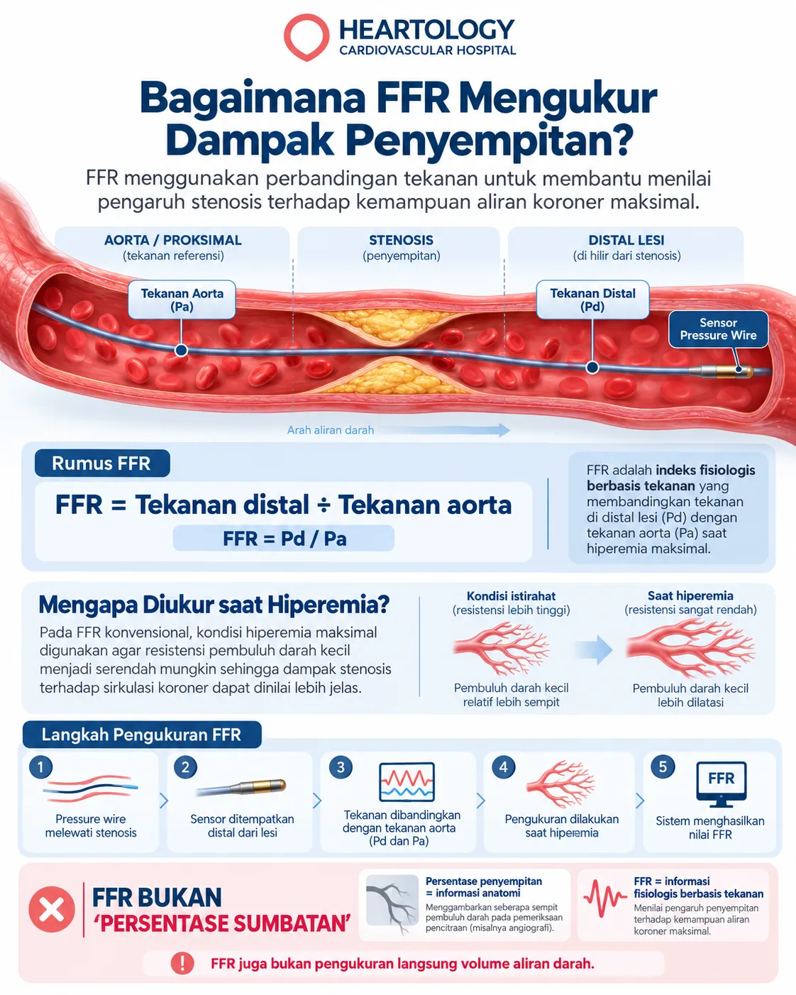 Infografik medis Heartology tentang cara FFR mengukur dampak penyempitan arteri koroner menggunakan pressure wire, sensor tekanan distal, tekanan aorta, dan konsep hiperemia. 