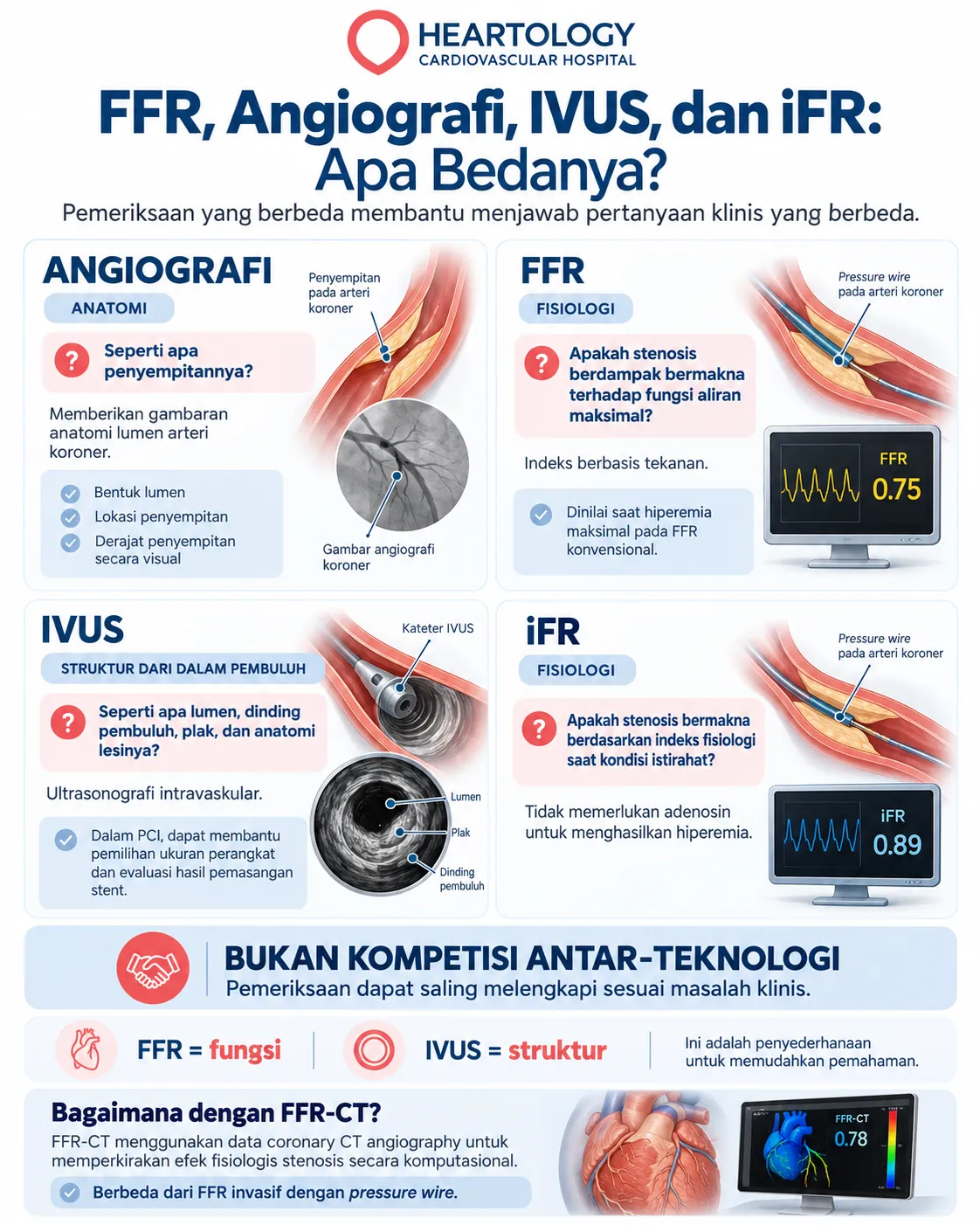 Infografik medis Heartology tentang perbedaan FFR, angiografi, IVUS, dan iFR, menampilkan empat panel perbandingan untuk menjelaskan fungsi masing-masing pemeriksaan dalam menilai anatomi, fisiologi, dan struktur pembuluh darah koroner. 