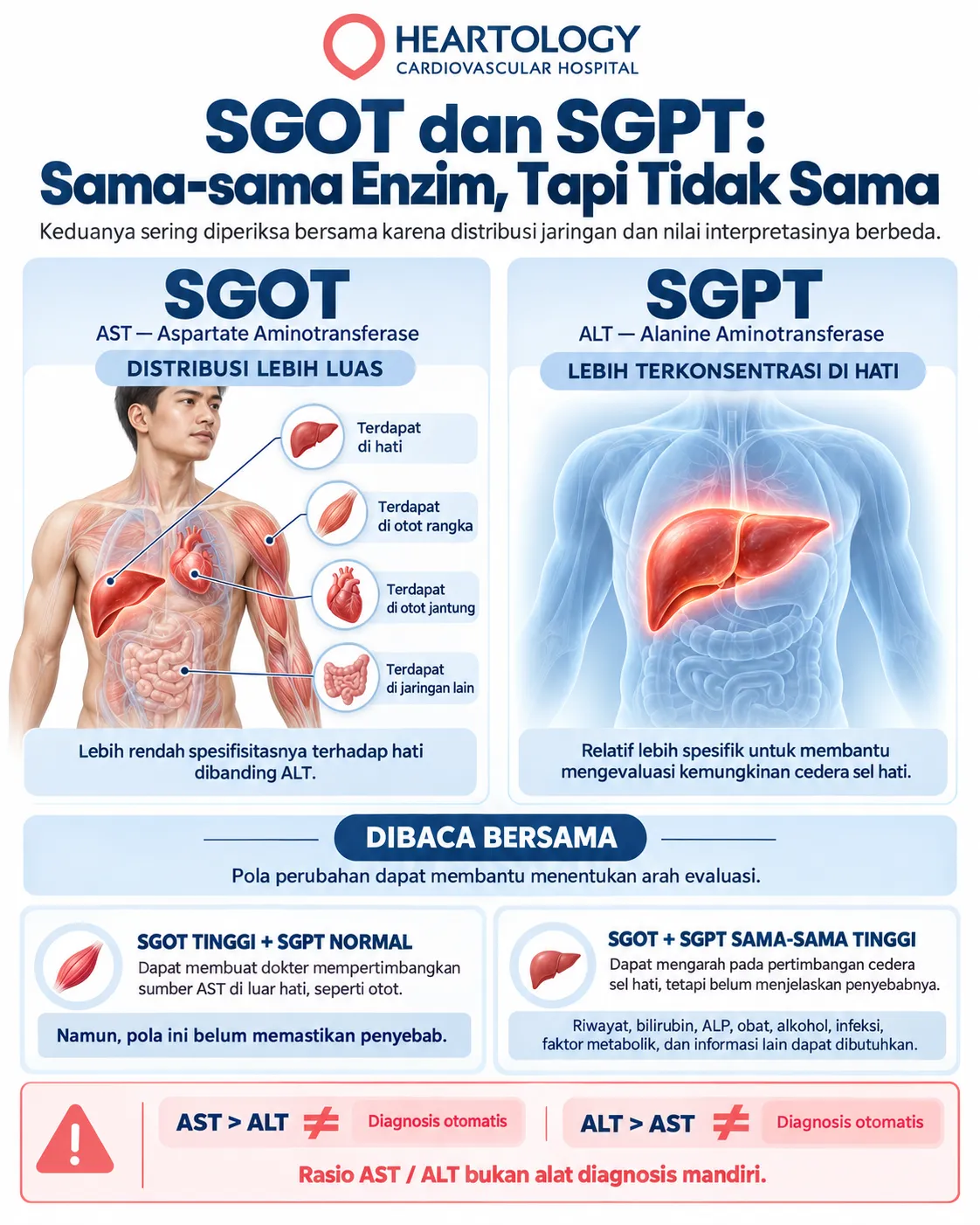 Infografik medis Heartology tentang perbedaan SGOT atau AST dan SGPT atau ALT, menampilkan bahwa AST tersebar lebih luas di hati, otot rangka, otot jantung, dan jaringan lain, sedangkan ALT lebih terkonsentrasi di hati, dengan penekanan bahwa rasio AST dan ALT bukan alat diagnosis mandiri. 