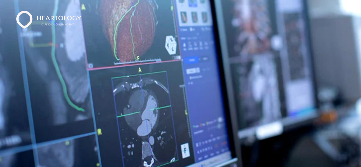 Cardiac Imaging Pentingnya untuk Kesehatan Jantung