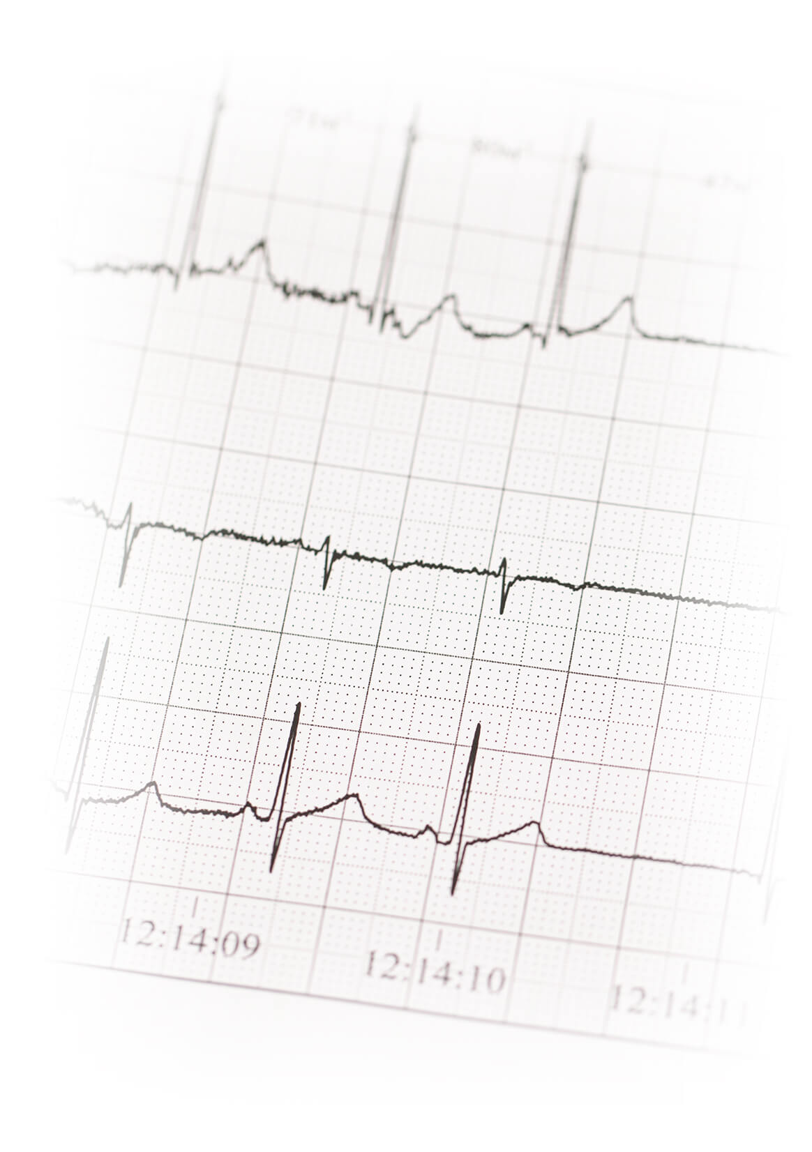 Heartology Cardiovascular Hospital - Centers of Excellence - Arrhythmia & Device Center
